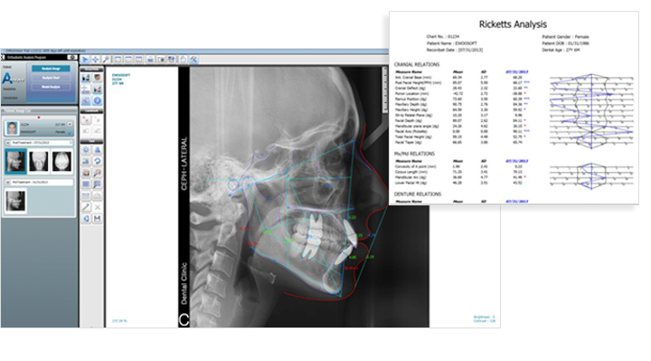 ortho extract software ortho extract software