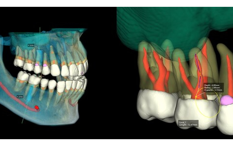Vatech Enhances AI in Dental Diagnostic Solutions