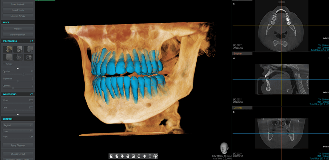 CT Scan Time Comparison